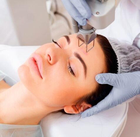 The laser of the face rejuvenates vitality