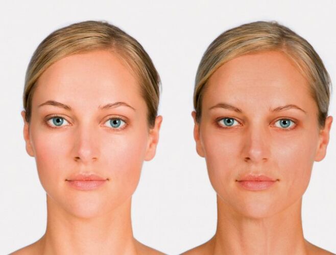 Face after and before