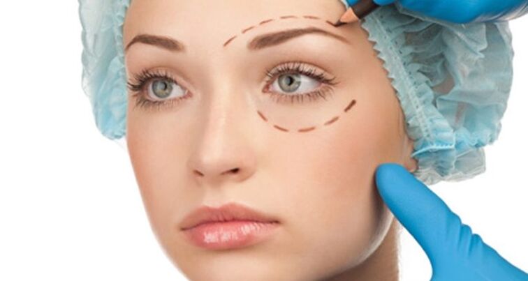 surgical lift