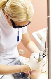 Doctor performs photothermolysis surgery