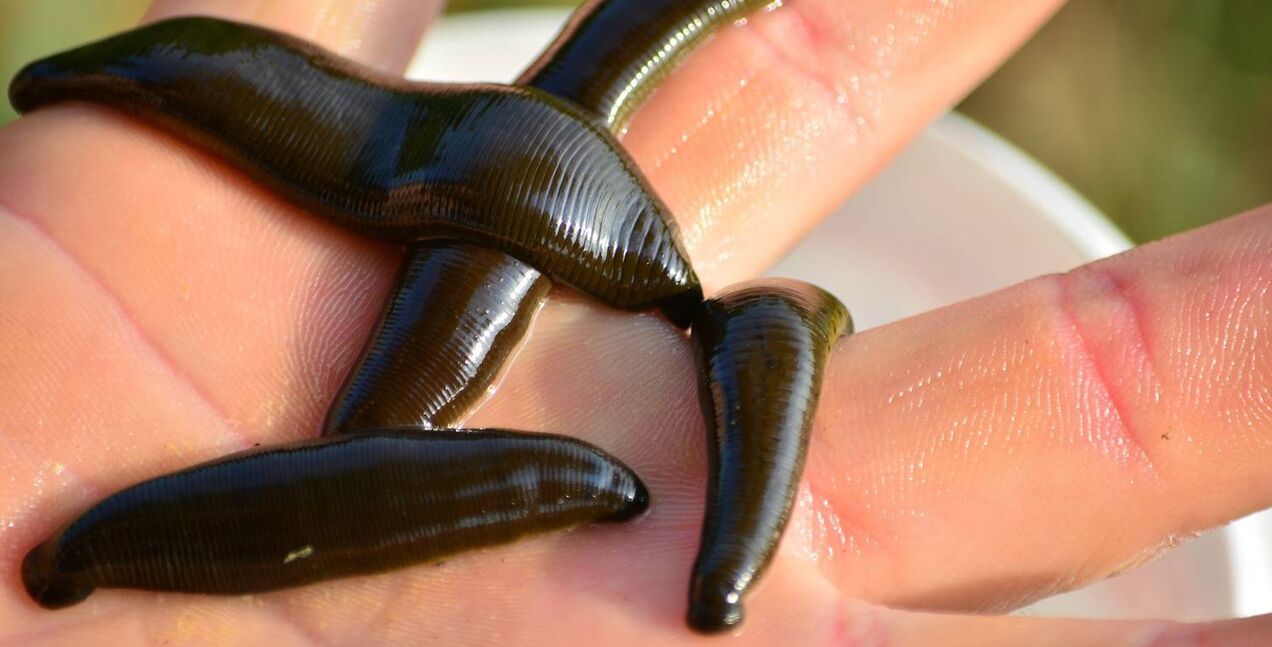Leech therapy as a method for facial skin rejuvenation